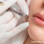 Lip Fillers Riverside