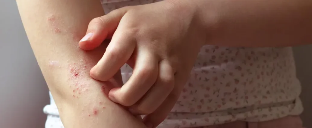 Fenbendazole 1000 manufacturer